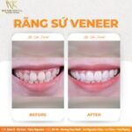 Răng ố vàng làm sao để trắng tại nhà 450144919_460596690059869_8654811260814432565_n