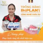 Những điều cần biết về bọc răng sứ toàn hàm 462702728_524816266971244_7928081786295848260_n