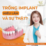 trồng răng imlant