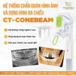 Nâng Xoang Trong Cấy Ghép Implant Nha Khoa: Tìm Hiểu Chi Tiết nâng xoang