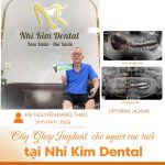 Khách Hàng Nguyễn Đăng thao  cấy implant 3 răng
