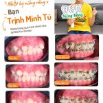 HÀNH TRÌNH CHỈNH NHA 1 NĂM CỦA TRỊNH MINH TÚ